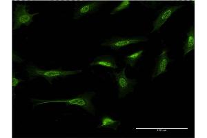Immunofluorescence of monoclonal antibody to CTNND2 on HeLa cell. (CTNND2 Antikörper  (AA 1081-1190))