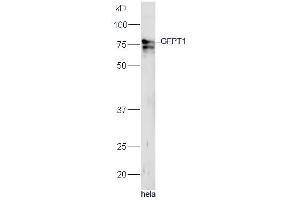 Human HeLa lysates probed with Rabbit Anti-GFPT1 Polyclonal Antibody, Unconjugated (ABIN1714093) at 1:300 overnight at 4˚C. (GFPT1 Antikörper  (AA 601-699))