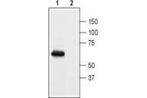 Western blot analysis of rat brain membranes:1.