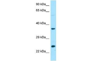 WB Suggested Anti-DTD1 Antibody Titration: 1. (DTD1 Antikörper  (C-Term))