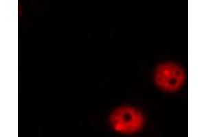 ABIN6267317 staining MOLT by IF/ICC. (Retinoblastoma 1 Antikörper  (pSer807))
