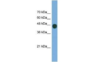 WB Suggested Anti-ARFGAP1 Antibody Titration: 0. (ARFGAP1 Antikörper  (Middle Region))