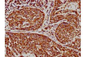 IHC image of ABIN7127868 diluted at 1:73. (Rekombinanter VDAC1 Antikörper)