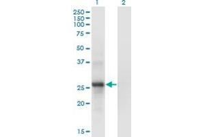 Western Blot analysis of SNF8 expression in transfected 293T cell line by SNF8 monoclonal antibody (M01), clone 6B11. (SNF8 Antikörper  (AA 23-122))