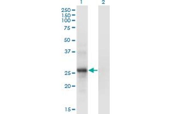 SNF8 antibody  (AA 23-122)