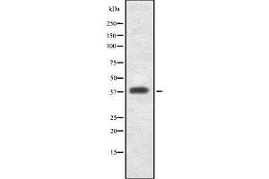 Western blot analysis GDF1 using K562 whole cell lysates (GDF1 Antikörper  (N-Term))