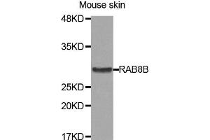 Western Blotting (WB) image for anti-RAB8B, Member RAS Oncogene Family (RAB8B) antibody (ABIN1875675) (RAB8B Antikörper)