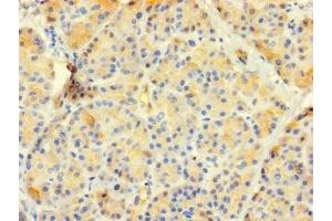 Immunohistochemistry of paraffin-embedded human pancreatic tissue using ABIN7147746 at dilution of 1:100 (CTRB1 Antikörper  (AA 19-263))