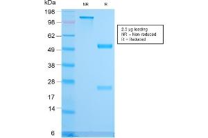 SDS-PAGE Analysis Purified CD79b Recombinant Rabbit Monoclonal Antibody (IGB/3170R). (Rekombinanter CD79b Antikörper  (AA 29-159))