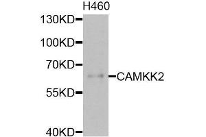 Western blot analysis of extracts of H460 cells, using CAMKK2 antibody (ABIN6003631) at 1/1000 dilution. (CAMKK2 Antikörper)