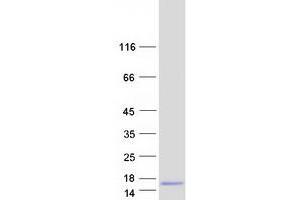 Western Blotting (WB) image for Dynein, Light Chain, LC8-Type 1 (DYNLL1) (Transcript Variant 2) protein (Myc-DYKDDDDK Tag) (ABIN2719877)