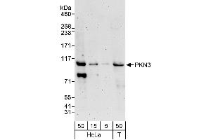 anti-Protein Kinase N3 (PKN3) (AA 225-275) antibody