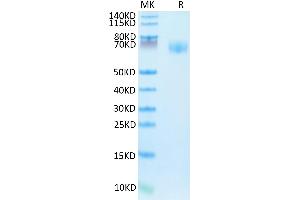 Human IFNGR1 on Tris-Bis PAGE under reduced condition. (IFNGR1 Protein (AA 18-245) (Fc Tag))