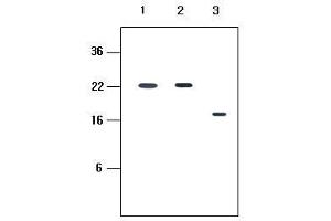 Human recombinant protein kIR2DL1, kIR2DL3 and kIR2DL4 (each 20ng per well) were resolved by SDS-PAGE, transferred to PVDF membrane and probed with anti-human kIR2D (1:500). (KIR2D Antikörper  (AA 44-202))