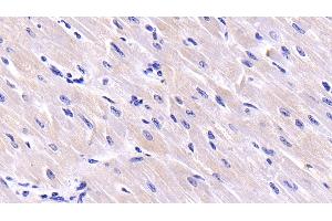 Detection of CSN3 in Bovine Cardiac Muscle Tissue using Polyclonal Antibody to Casein Kappa (CSN3) (CSN3 Antikörper  (AA 22-190))