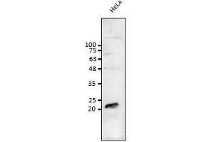 Anti-Rab1b Ab at 1/1,000 dilution: lysates at 50 µg per Iane, rabbit polyclonal to goat (HRP) at 1/10,000 dilution, (RAB1B Antikörper  (C-Term))