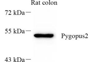 Western blot analysis of Pygopus2 (ABIN7075325) at dilution of 1: 300 (PYGO2 Antikörper)