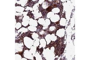 Immunohistochemical staining of human bone marrow with KIAA1984 polyclonal antibody  shows strong cytoplasmic and nuclear positivity in hematopoietic cells at 1:200-1:500 dilution. (CCDC183/KIAA1984 Antikörper)