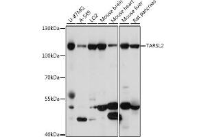 Western blot analysis of extracts of various cell lines, using T antibody (ABIN7270816) at 1:1000 dilution. (TARSL2 Antikörper  (AA 1-170))