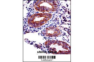 PHF16 Antibody immunohistochemistry analysis in formalin fixed and paraffin embedded human uterus tissue followed by peroxidase conjugation of the secondary antibody and DAB staining.