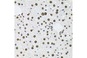 Immunohistochemistry of paraffin-embedded mouse liver using MCL1 antibody at dilution of 1:100 (x40 lens). (MCL-1 Antikörper)
