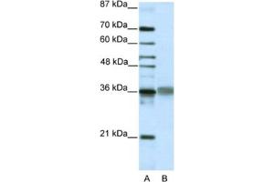 Western Blotting (WB) image for anti-T-Cell Leukemia Homeobox 2 (TLX2) antibody (ABIN2461873) (TLX2 Antikörper)