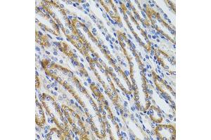 Immunohistochemistry of paraffin-embedded mouse kidney using HEXA antibody (ABIN6127519, ABIN6141730, ABIN6141732 and ABIN6216071) at dilution of 1:100 (40x lens).