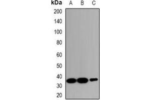 Western blot analysis of ZNT2 expression in HeLa (A), RAW264. (SLC30A2 Antikörper)