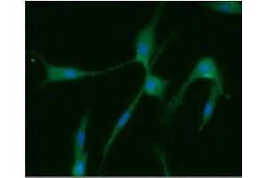 ICC/IF analysis of Homer1 in U87MG cells line, stained with DAPI (Blue) for nucleus staining and monoclonal anti-human Homer1 antibody (1:100) with goat anti-mouse IgG-Alexa fluor 488 conjugate (Green). (HOMER1 Antikörper  (AA 1-354))
