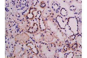 Formalin-fixed and paraffin embedded rat kidney labeled with Rabbit Anti-ABI3 Polyclonal Antibody, Unconjugated  at 1:200 followed by conjugation to the secondary antibody and DAB staining (ABI3 Antikörper  (AA 151-250))
