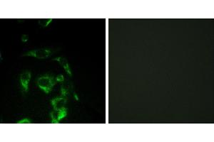 Peptide - +Immunohistochemistry analysis of paraffin-embedded human colon carcinoma tissue using Eif4g antibody. (EIF4G1 Antikörper  (Internal Region))