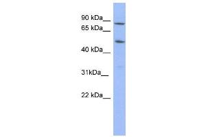 WB Suggested Anti-TRIM10  Antibody Titration: 0. (TRIM10 Antikörper  (N-Term))