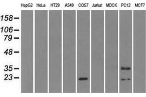 Western blot analysis of extracts (35 µg) from 9 different cell lines by using anti-CRYAB monoclonal antibody. (CRYAB Antikörper)