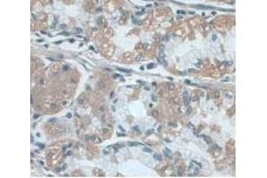 IHC-P analysis of Human Stomach Tissue, with DAB staining. (UCP2 Antikörper  (AA 154-289))