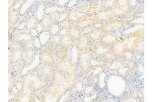 ABIN6261932 and ABIN6277595 at 1/100 staining human normal kidney tissue by IHC-P. (GDI1 Antikörper  (Internal Region))