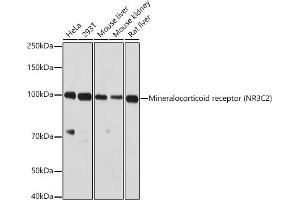 Western blot analysis of extracts of various cell lines, using Mineralocorticoid receptor (NR3C2) antibody (ABIN1681109, ABIN3017672, ABIN3017673 and ABIN6220207) at 1:1000 dilution. (NR3C2 Antikörper  (C-Term))