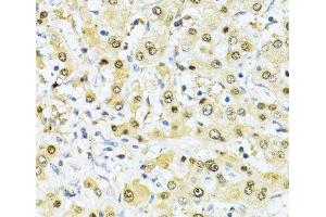 Immunohistochemistry of paraffin-embedded Human liver using ITGB3BP Polyclonal Antibody at dilution of 1:100 (40x lens). (ITGB3BP Antikörper)