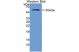 Western blot analysis of the recombinant protein. (NUP153 Antikörper  (AA 1238-1468))