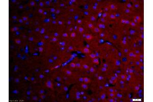 Formalin-fixed and paraffin-embedded rat brain labeled with Anti-DFFB Polyclonal Antibody, Unconjugated (ABIN724085) 1:200, overnight at 4°C, The secondary antibody was Goat Anti-Rabbit IgG, Cy3 conjugated used at 1:200 dilution for 40 minutes at 37°C. (DFFB Antikörper  (AA 201-260))