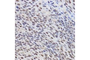 Immunohistochemistry (IHC) image for anti-Activating Transcription Factor 3 (ATF3) (AA 1-181) antibody (ABIN6137233)