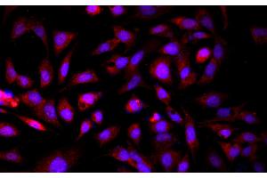 Immunofluorescence analysis of HepG2 cells using GCK Polyclonal Antibody at dilution of 1:100 (GCK Antikörper)