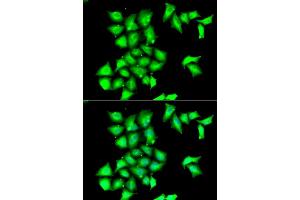 Immunofluorescence analysis of HeLa cells using MSRB1 antibody (ABIN6129123, ABIN6144089, ABIN6144090 and ABIN6222462).