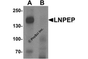 Western Blotting (WB) image for anti-Leucyl/cystinyl Aminopeptidase (LNPEP) (C-Term) antibody (ABIN1077382) (LNPEP Antikörper  (C-Term))