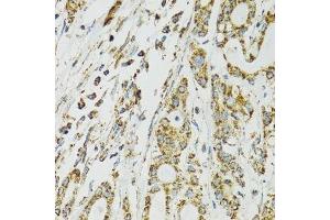 Immunohistochemistry (Paraffin-embedded Sections) (IHC (p)) image for anti-Heat Shock 70kDa Protein 9 (Mortalin) (HSPA9) (AA 380-679) antibody (ABIN3021000)