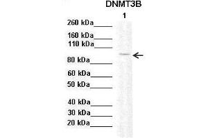 Sample Type :  Lane 1: 20ug mouse mesenchymal stem cell lysate  Primary Antibody Dilution :   1:2000  Secondary Antibody:  Anti-rabbit-HRP  Secondary Antibody Dilution:   1:10,000  Color/Signal Descriptions:  DNMT3B  Gene Name:  Anonymous  Submitted by: (DNMT3B Antikörper  (Middle Region))