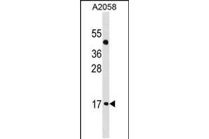Western blot analysis in A2058 cell line lysates (35ug/lane). (ATOH7 Antikörper  (AA 85-112))