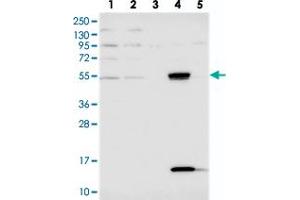 Western blot analysis of Lane 1: RT-4, Lane 2: U-251 MG, Lane 3: Human Plasma, Lane 4: Liver, Lane 5: Tonsil with UFSP2 polyclonal antibody  at 1:250-1:500 dilution.