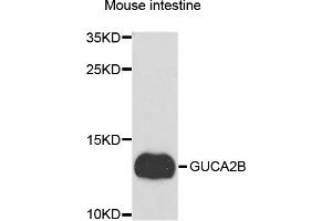 Western blot analysis of extracts of mouse small intestine, using GUCA2B antibody. (GUCA2B Antikörper)