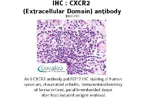 Image no. 1 for anti-Chemokine (C-X-C Motif) Receptor 2 (CXCR2) (2nd Extracellular Domain) antibody (ABIN1733394) (CXCR2 Antikörper  (2nd Extracellular Domain))