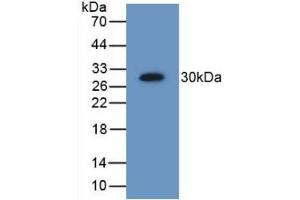 Western Blotting (WB) image for anti-Proteasome (Prosome, Macropain) 26S Subunit, Non-ATPase, 9 (PSMD9) (AA 2-223) antibody (ABIN7442213)